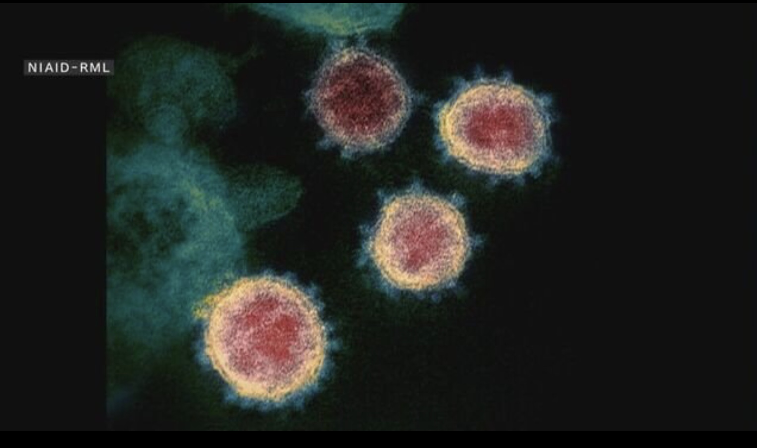 コロナ感染者が大変です